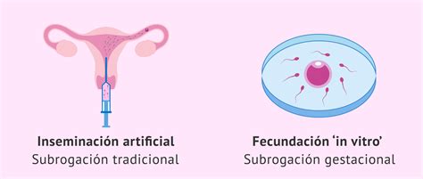 Maternidad subrogada para hombres solteros o del mismo sexo